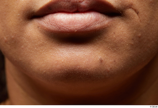 HD Face Skin Elvira Jairo chin face lips mouth scar…